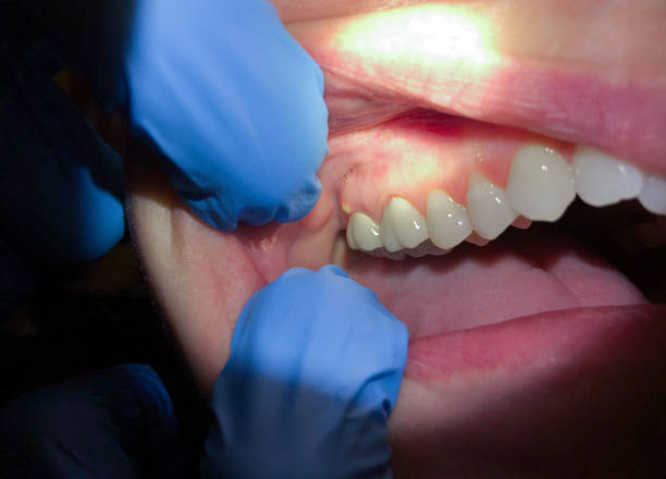 Best Cosmetic Emergency Dentistry in Thompsonville, PA