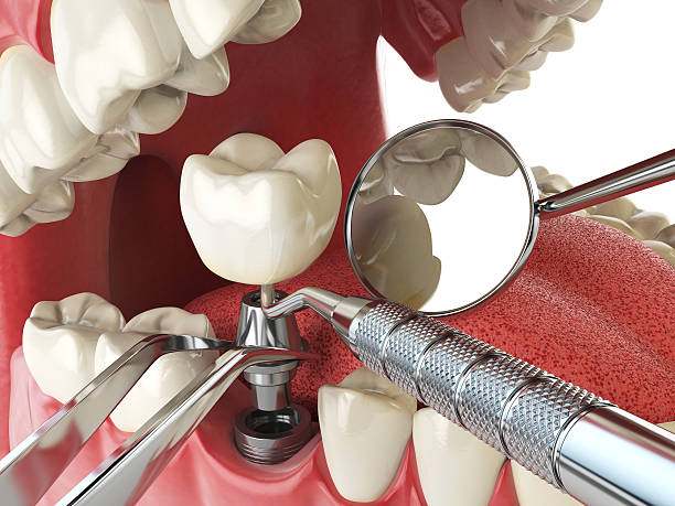 Best Emergency Denture Repair in Thompsonville, PA