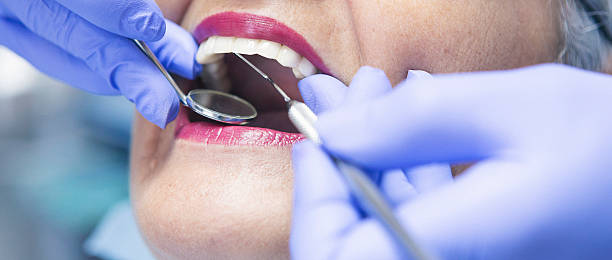 Best Emergency Dental Care for Broken or Chipped Teeth in Thompsonville, PA